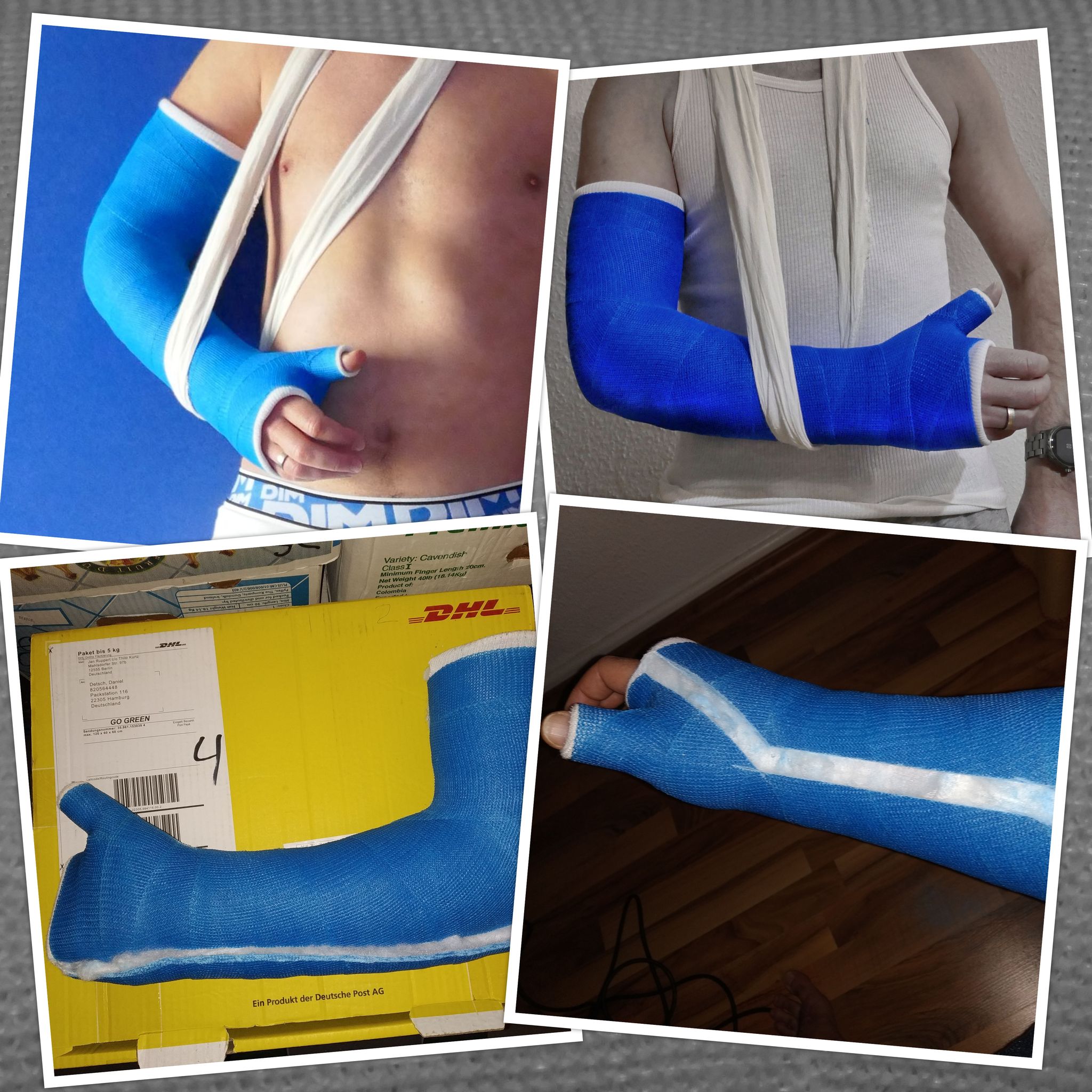 Casts for Sale The GaySkaterCaster